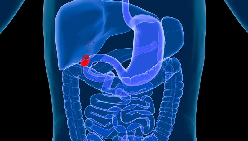 Hemorrhoid / Piles -Treatments