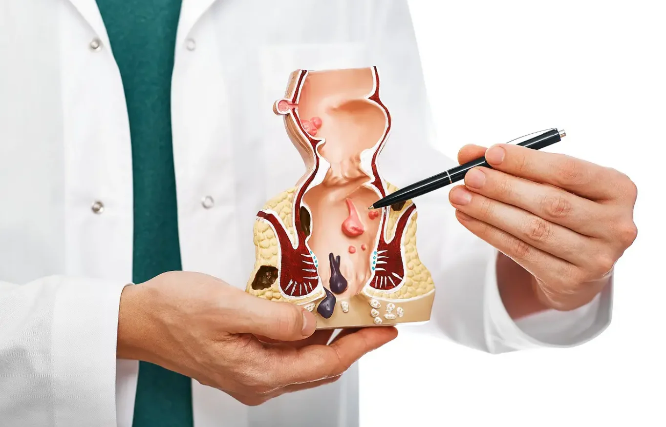 anal cancer surgery