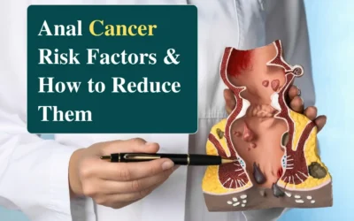 Anal Cancer Risk Factors and Prevention Tips