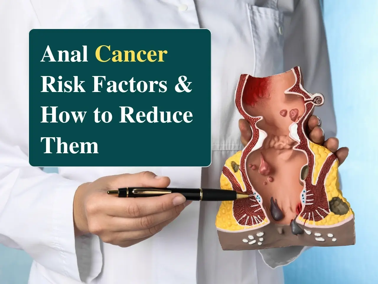 Anal Cancer Risk Factors