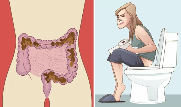 Can Haemorrhoids Cause Constipation?