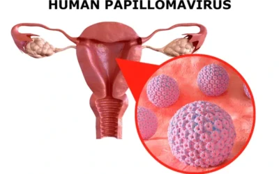 How HPV Causes Anal Cancer?