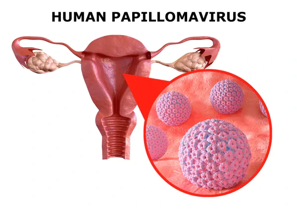 How HPV Causes Anal Cancer?