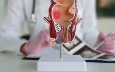 Fistula in Ano: Symptoms & Effective Treatments