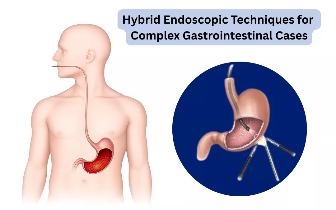 Hybrid Endoscopic Techniques for Complex Gastrointestinal Cases
