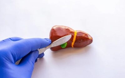 What Happens After Gallbladder Removal?