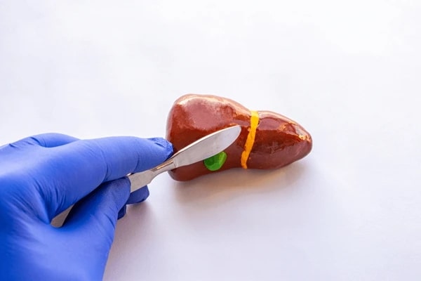 What Happens After Gallbladder Removal?