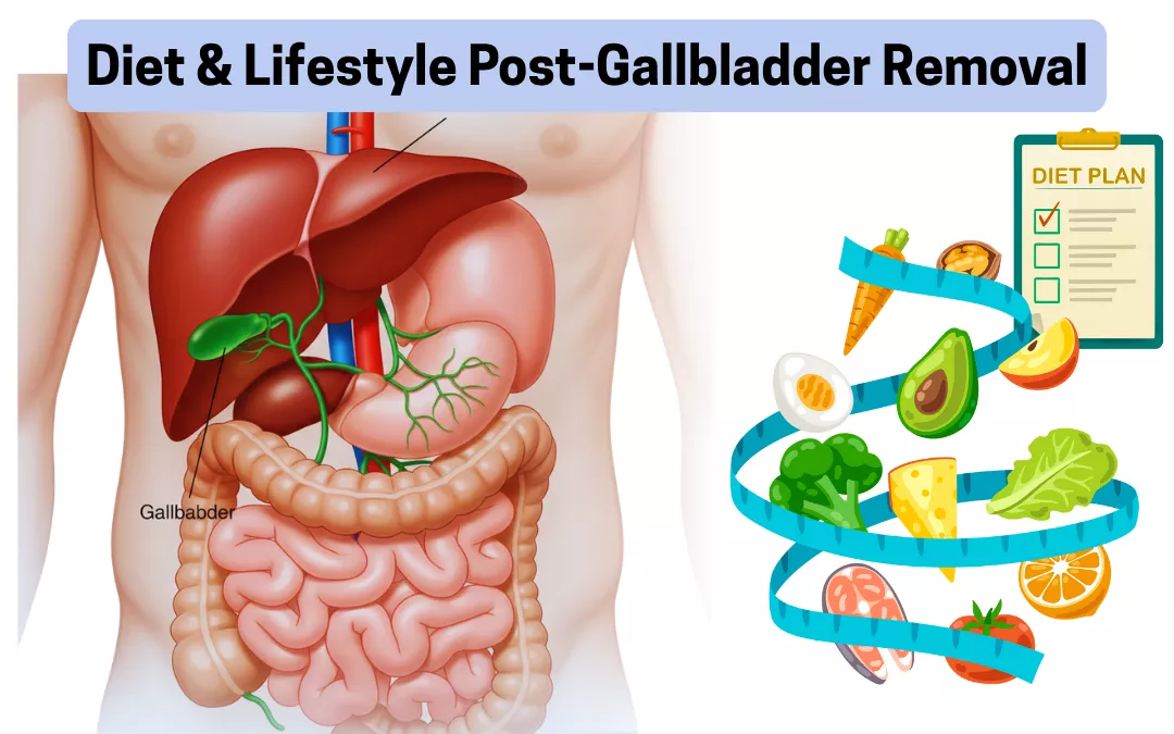 What Happens After Gallbladder Removal?