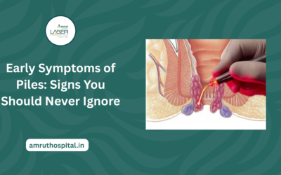 Early Symptoms of Piles: Signs You Should Never Ignore