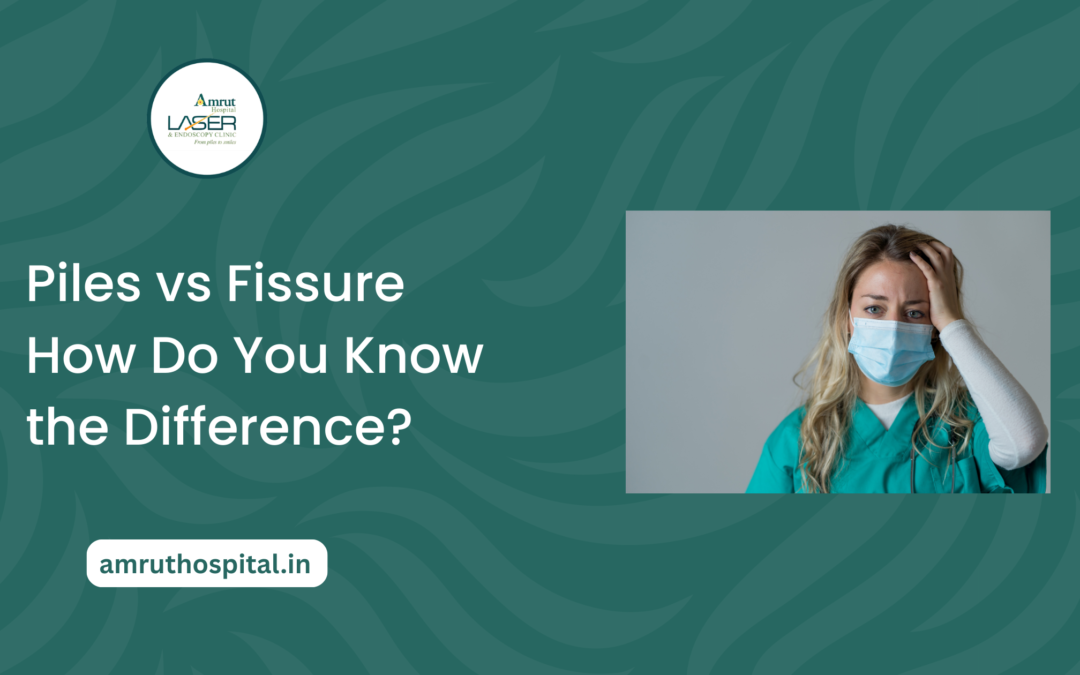 Piles vs Fissure How Do You Know the Difference?