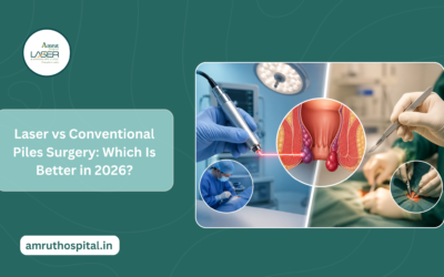 Laser vs Conventional Piles Surgery: Which Is Better in 2026?