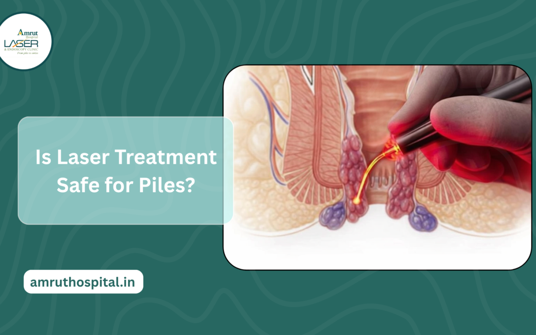 Is Laser Treatment Safe for Piles?