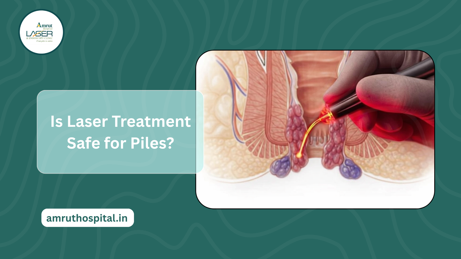 laser piles treatment in dombivli
