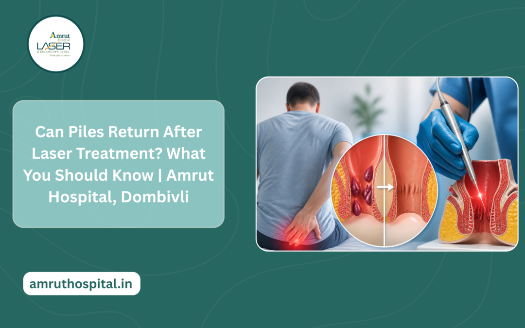 Piles Return After Laser Treatment? What You Should Know | Amrut Hospital, Dombivli?