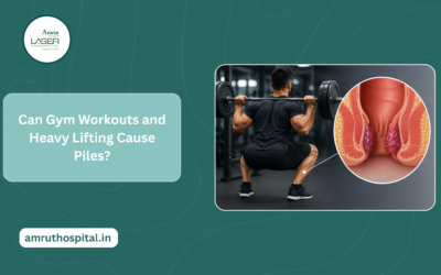 Can Gym Workouts and Heavy Lifting Cause Piles?